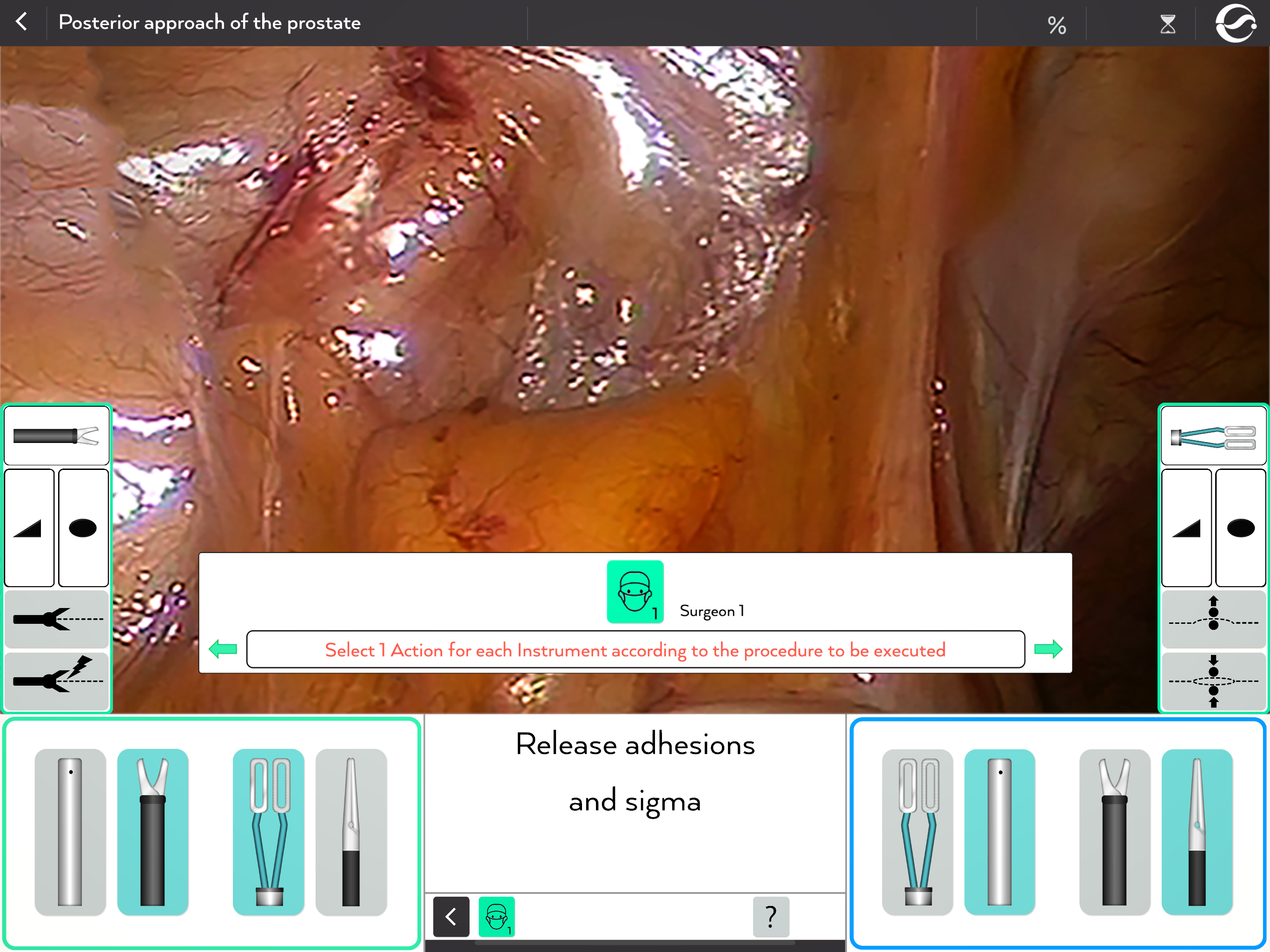 Selection of the Action for each Instrument according to the Procedure to be executed